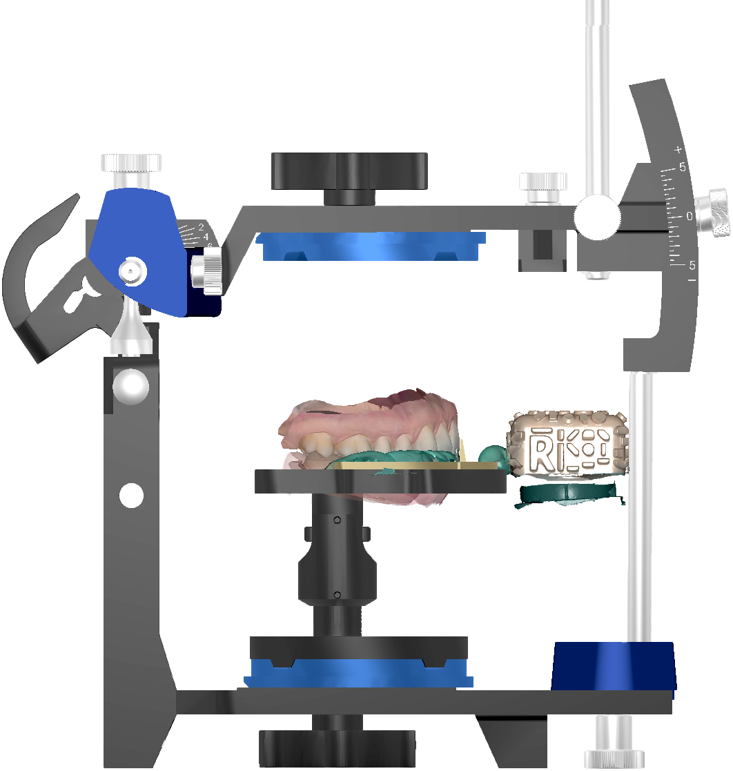 Oriented mesh and Kois Scan Body reference in a virtual articulator