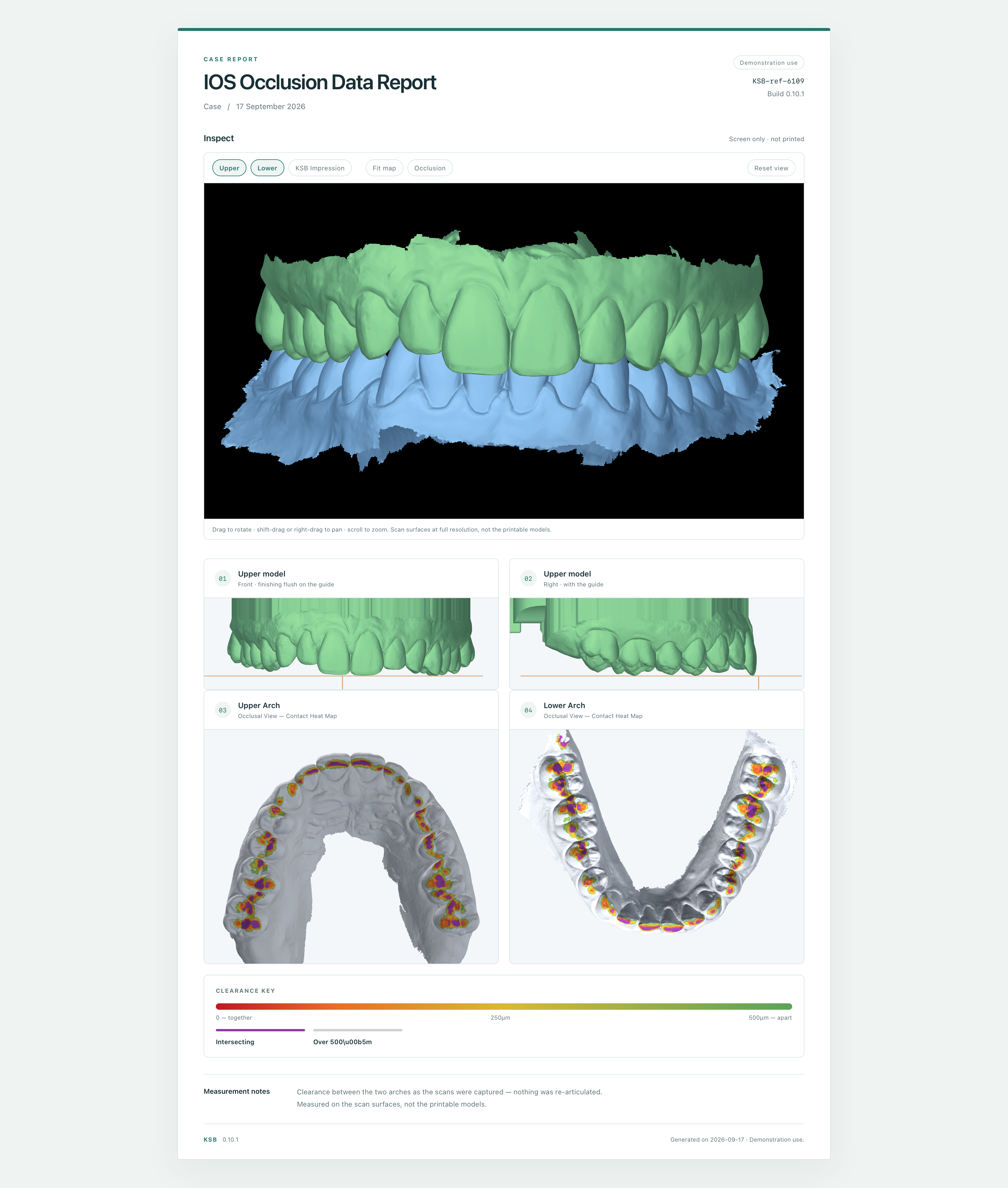 Case report